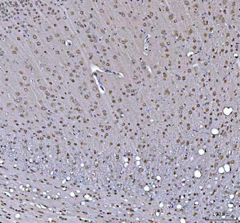 RTCB Rabbit Polyclonal Antibody