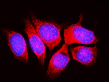 RPL11 Rabbit Polyclonal Antibody