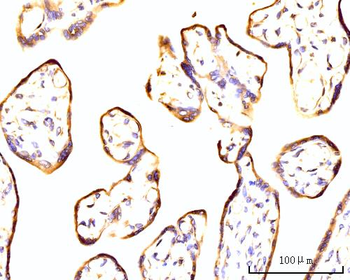 RPL11 Rabbit Polyclonal Antibody