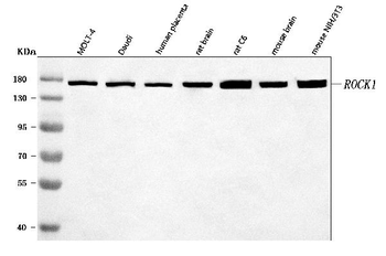 ROCK1 Rabbit Polyclonal Antibody