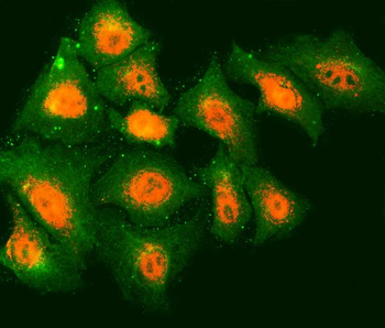 TMOD2 Rabbit Polyclonal Antibody