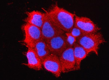 OMP Rabbit Polyclonal Antibody