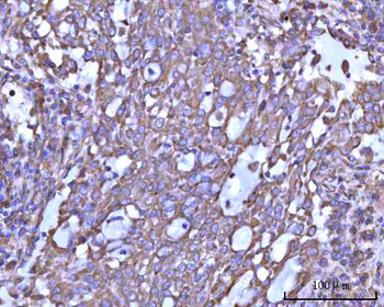 RPS14 Rabbit Polyclonal Antibody