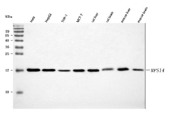 RPS14 Rabbit Polyclonal Antibody