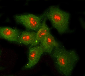 RNASEH1 Rabbit Polyclonal Antibody