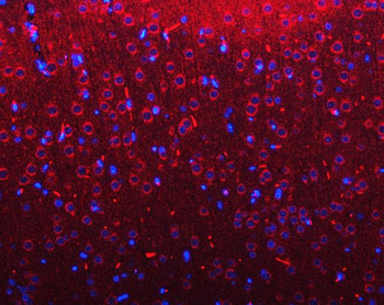 RIMBP2 Rabbit Polyclonal Antibody