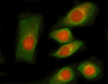 RNGTT Rabbit Polyclonal Antibody