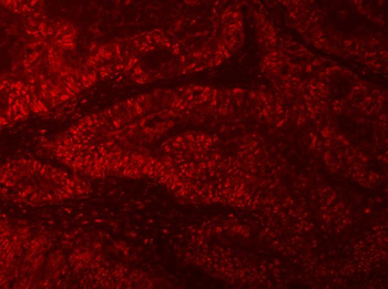RNGTT Rabbit Polyclonal Antibody