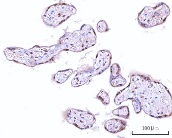 RNGTT Rabbit Polyclonal Antibody