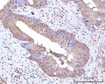 RNGTT Rabbit Polyclonal Antibody