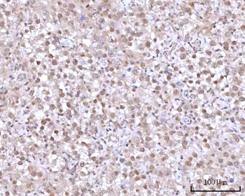 RNGTT Rabbit Polyclonal Antibody