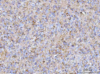 PTN Rabbit Polyclonal Antibody