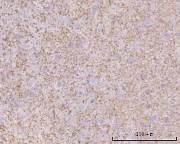 PTN Rabbit Polyclonal Antibody