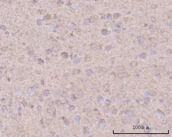 PTN Rabbit Polyclonal Antibody