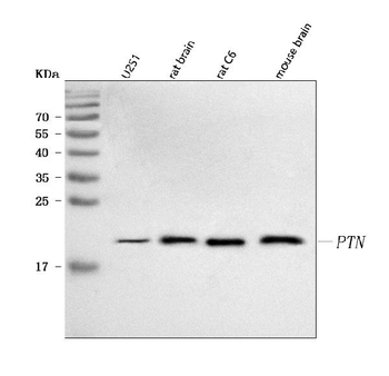 PTN Rabbit Polyclonal Antibody