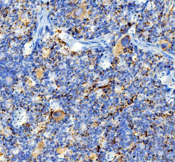 CD41/Integrin Alpha 2B/ITGA2B Rabbit Polyclonal Antibody