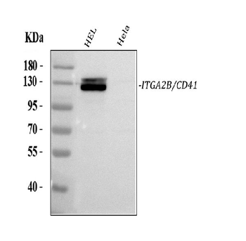 CD41/Integrin Alpha 2B/ITGA2B Rabbit Polyclonal Antibody