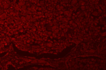 RNF40 Rabbit Polyclonal Antibody