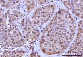 RNF40 Rabbit Polyclonal Antibody