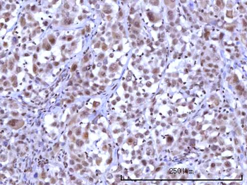 RNF40 Rabbit Polyclonal Antibody