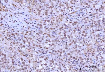 RNF40 Rabbit Polyclonal Antibody