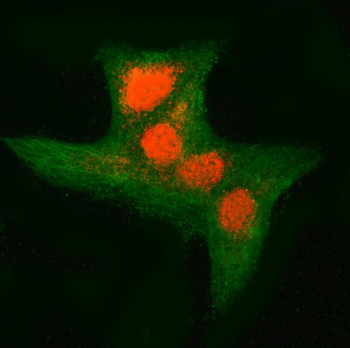 RNF34 Rabbit Polyclonal Antibody