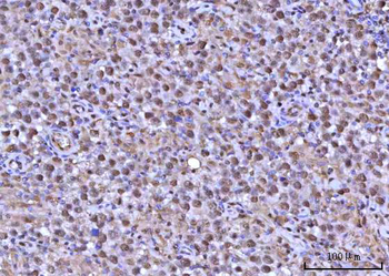 RNF34 Rabbit Polyclonal Antibody