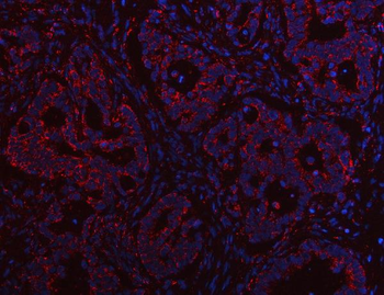 PTPIP51/RMDN3 Rabbit Polyclonal Antibody