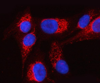 PTPIP51/RMDN3 Rabbit Polyclonal Antibody