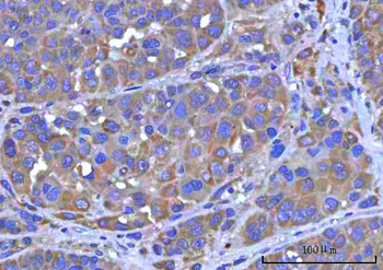 PTPIP51/RMDN3 Rabbit Polyclonal Antibody