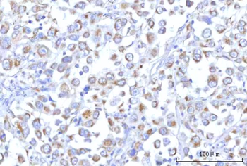 PTPIP51/RMDN3 Rabbit Polyclonal Antibody
