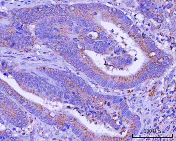 PTPIP51/RMDN3 Rabbit Polyclonal Antibody