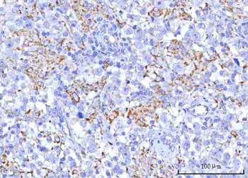 PTPIP51/RMDN3 Rabbit Polyclonal Antibody