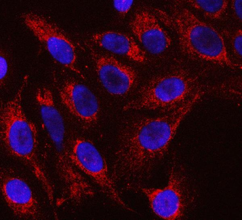 RFTN1 Rabbit Polyclonal Antibody