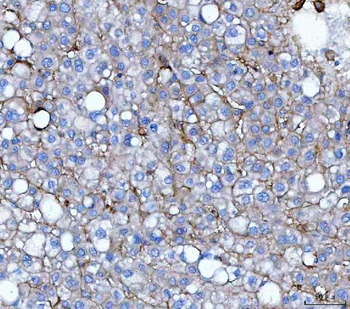 CD276 Rabbit Polyclonal Antibody
