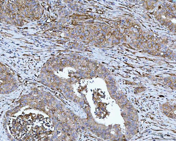 CD276 Rabbit Polyclonal Antibody