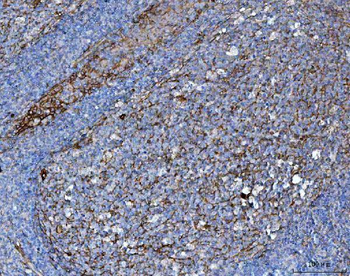 CD276 Rabbit Polyclonal Antibody