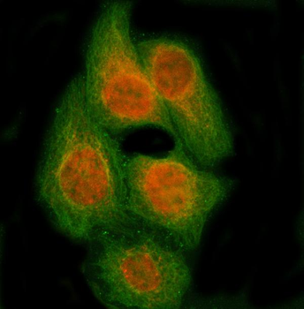 RBM14 Rabbit Polyclonal Antibody