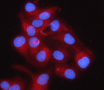 RPS5 Rabbit Polyclonal Antibody
