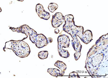 RPS5 Rabbit Polyclonal Antibody