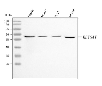 RETSAT Rabbit Polyclonal Antibody