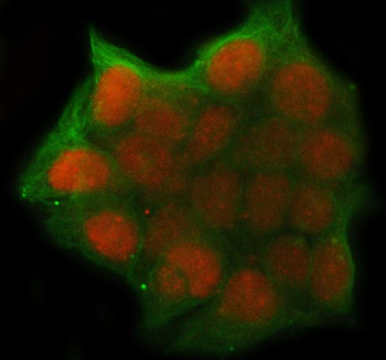 UHRF1 Rabbit Polyclonal Antibody