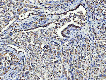 Asparagine synthetase/ASNS Rabbit Polyclonal Antibody