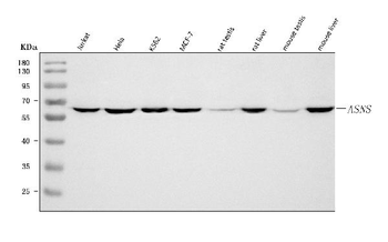 Asparagine synthetase/ASNS Rabbit Polyclonal Antibody