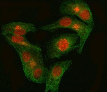 EZH1 Rabbit Polyclonal Antibody