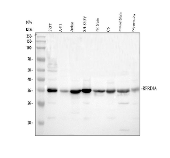 P15RS/RPRD1A Rabbit Polyclonal Antibody