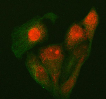 P15RS/RPRD1A Rabbit Polyclonal Antibody