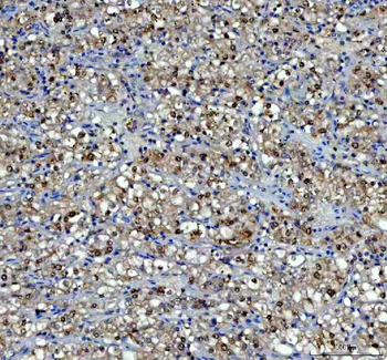 P15RS/RPRD1A Rabbit Polyclonal Antibody