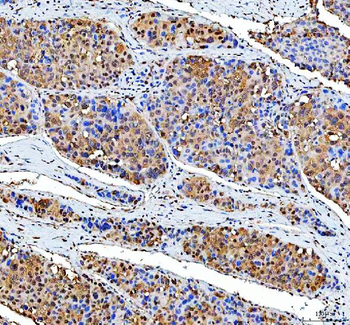 P15RS/RPRD1A Rabbit Polyclonal Antibody