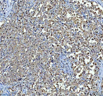 P15RS/RPRD1A Rabbit Polyclonal Antibody